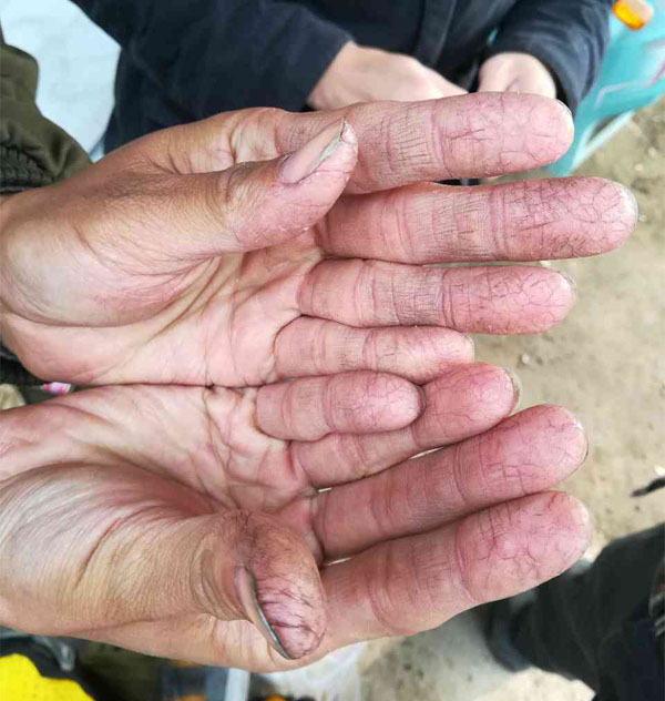 李工的手都開(kāi)裂了